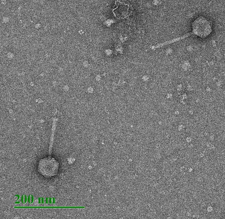 Bacteriophage - Image taken by Oregon Coast Community College