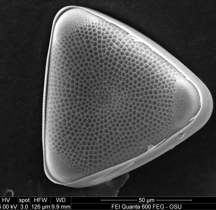 Triceratium Diatom - Image taken by Yaya 